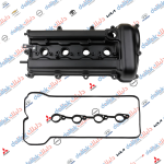 قبق ولفات النترا-فورتي 1.6 2013 -HF